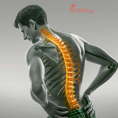 Terapia con células madre para la enfermedad degenerativa del disco en Colombia: Lo que debe saber